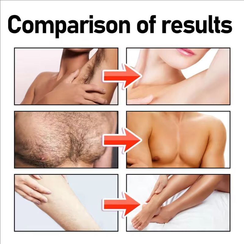 Hair Removal Cream Underarm Lip Private Parts Gentle Depilator Inhibiting Hair Growth Smooth Painless Shaving Depilatory Cream