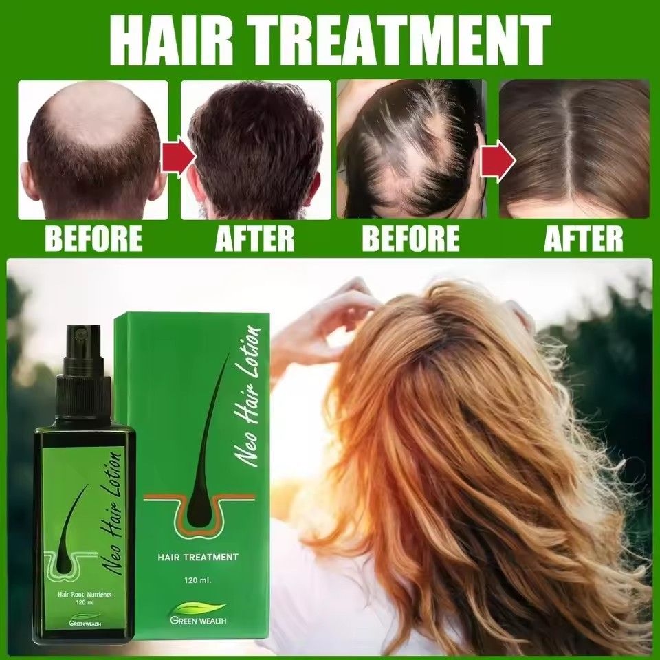 Original Thailand Neo Hair Lotion Paradise 120ml Hair Growth Oil Capillary Tonic For Growth Anti Hair Loss Scalp Treatments Men