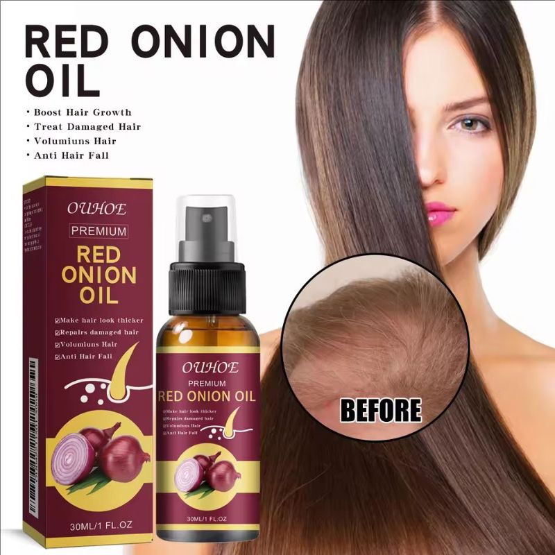 Red Onion Hair Growth Essential Oil Hair Care Spray Prevent Hair Loss Nourish Hair Roots Improve Hair Texture Hair Care Products