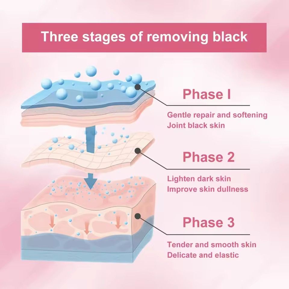 Body Bleaching Cream Brighten Dark Intimate Private Parts Knees Thigh Inner Joint Bikini Remove Melanin Underarm Whitening Cream