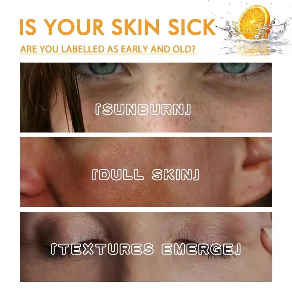 Vitamin C Whitening Face Serum Remove Dark Spots Freckles Fade Melanin Pigment Brightening Anti-Wrinkle Essence Beauty Skin Care