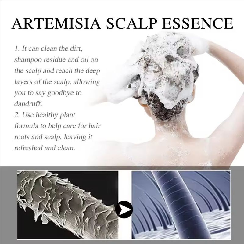 Anti Dandruff Hair Treatment Anti Itching Oil Control Scalp Seborrheic Shampoo Smoothing Moisturizes Repair Frizzy Damaged Hair