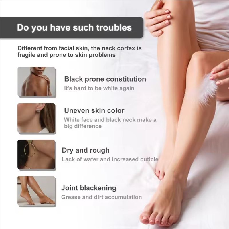 Jaysuing Body Whiten-ing Cream Private Parts Dark Underarm Bleaching Moisturizer Remove Melanin Neck Knees Elbow Brighten Lotion