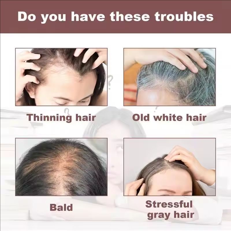 100g Herbal Hair Growth Anti Hair Loss Moisturizing Volumizing Shampoo Soap Organic Polygonum Hair Darkening Soap Bar