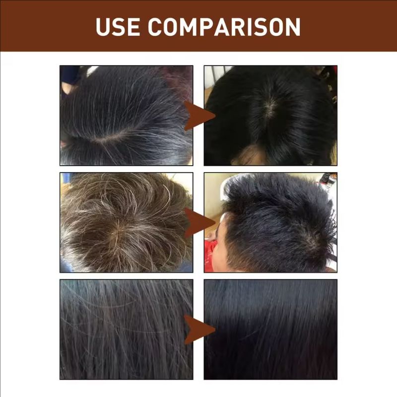 Hair Shampoo Gray White Hair Treatment Anti Loss Polygonum Essence Natural Color Repair Nourishing Hair Darkening Shampoo Soap