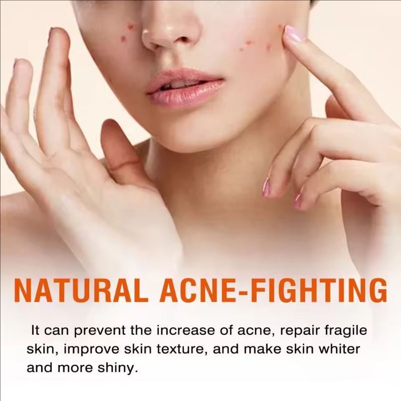 Salicylic Acid Mask Fade Acne Marks Blackheads Removal Shrink Pores Cleansing Repair Nourish W-hitening Pimple T-reatment Cream