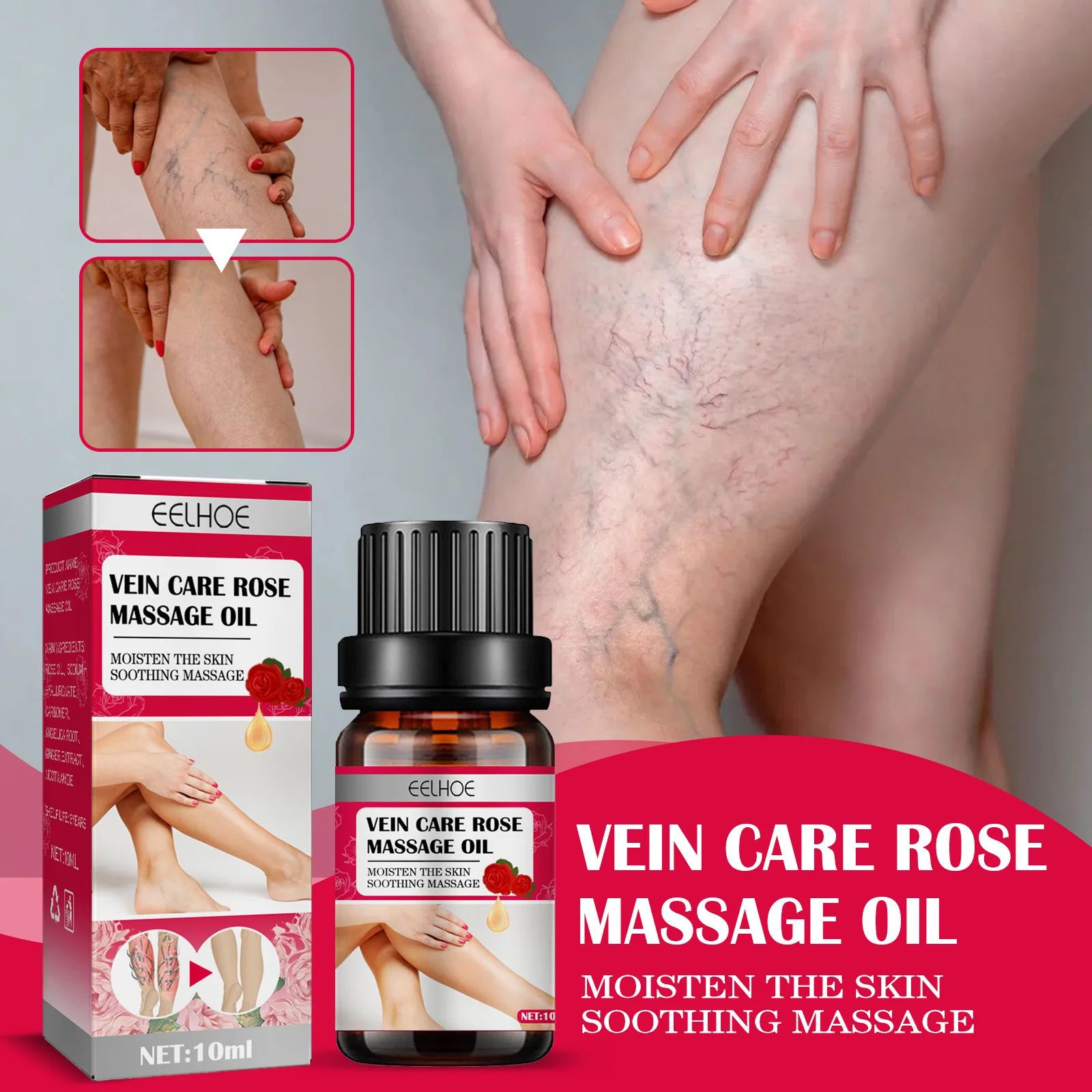 Rose Vein Care Essential Oil Improve Vasculitis Phlebitis Blood Circulation Lymphatic Leg Massage Care Varicose Vein Removal Oil
