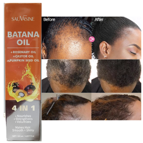 Sauvasine Batana Oil 4 In 1 For Thicker Fuller Healthier Hair Nourish Strengthen And Transform Your Hair With The Power Of Batana