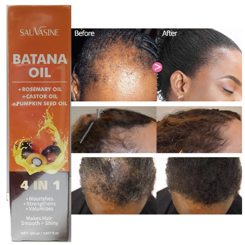 Sauvasine Batana Oil 4 In 1 For Thicker Fuller Healthier Hair Nourish Strengthen And Transform Your Hair With The Power Of Batana