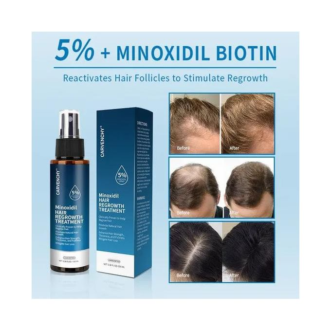 Carvenchy Minoxidil Hair Regrowth Treatment 5% With Biotin Potent Hair Revitalization Formula High Performance Scalp Treatment To Fortify Follicles Minimize Thinning And Enhance Natural Volume