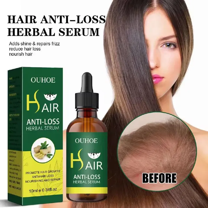 Fast Hair Growth Anti Alopecia Oil Ginger Essential High Hairline Head Hair Serum Hairless Baldhead Increase Essence Cream