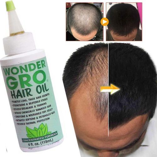 Wonder Gro Hair Oil Concentrated Formula