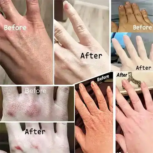 Collagen Anti-wrinkle Hand Cream Skin Soften Nourish Anti-drying Whitening Moisturizing African Skin Care Cracked Repair Products Hand Creams & Lotions