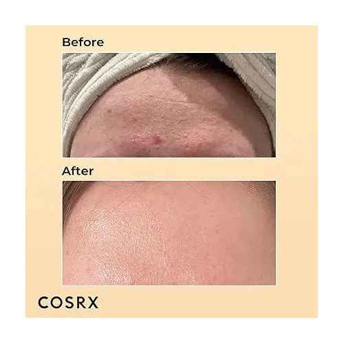 COSRX Advanced Snail 96 Mucin Power Essence. Deeply Moisturizes, Fades Dark Spots, Scars, Glows, Prevent Skin Aging, Hydrates, Glows & Remove Dull & Rough Skin