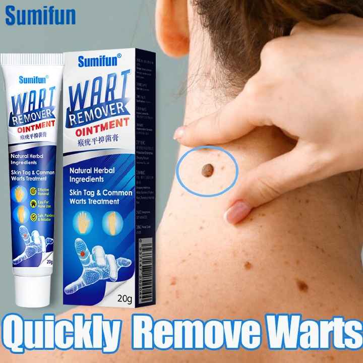 Original Warts Remover Ointment Skin Tag Removal Wart Treatment Cream Herbal Extract Foot Corn Antibacterial Warts Ointment- Sumifun