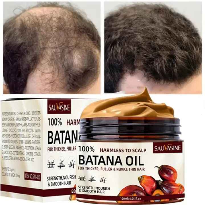 New Arrivals Batana Oil Fast Hair Growth for Women Men Pure Batana Oil Nourish Shiny Hair Healthy Hair Care Anti Hair Loss Hair Growth Care Repair Damaged For Men & Women - SAUVASINE -