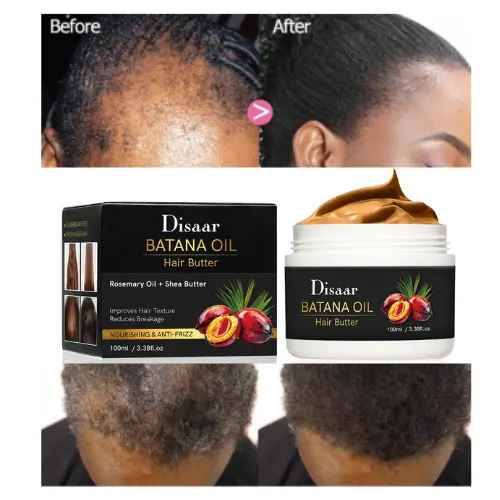 Disaar Batana Oil 100ml With Rosemary and Shea Butter For Fast Hair Growth Stronger Roots Thicker Edges Deep Repair For Dry Damaged Hair Breakage Control Healthy Scalp Support For Men And Women