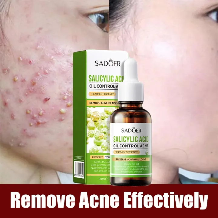 Salicylic Acid Pores Shrink Refining Serum Acne Repair Pore Removal Blackhead Hydrating and Moisturizing Facial Skin Care Serum - SADOER -