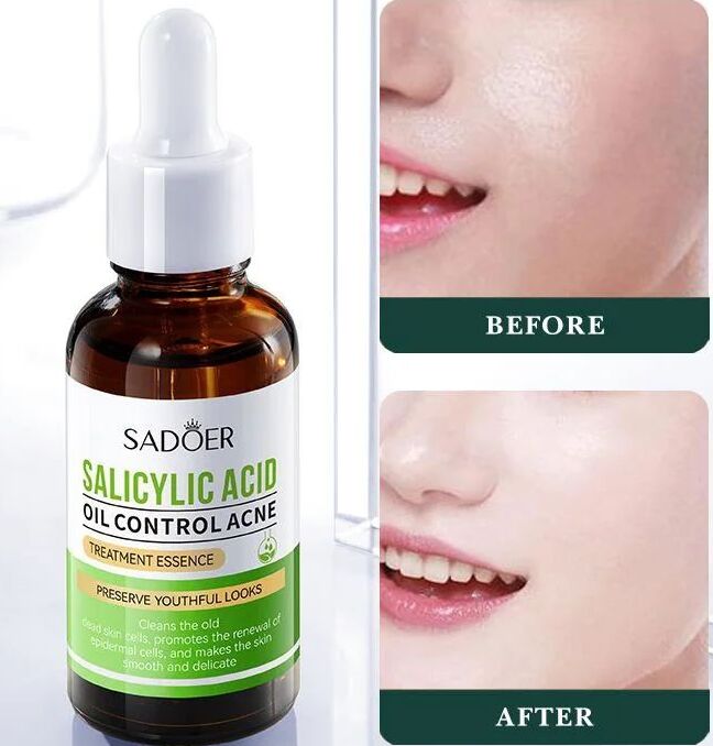 30ml Salicylic Acid Facial Serum Brightening & Hydrating Serum for Face, Acne Shrinks Pores, Nourishing & Tightening Skin