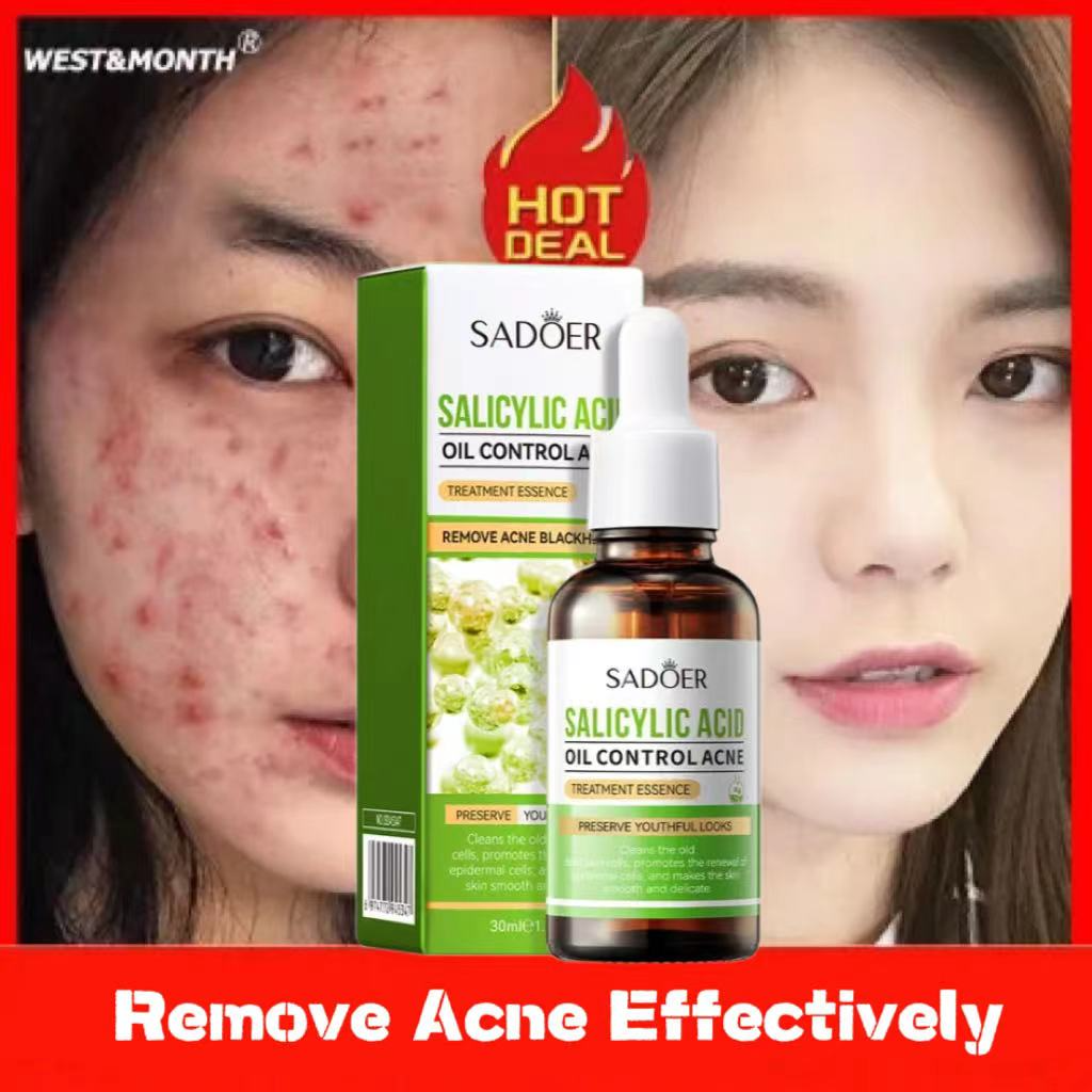 30ml Salicylic Acid Facial Serum Brightening & Hydrating Serum for Face, Acne Shrinks Pores, Nourishing & Tightening Skin