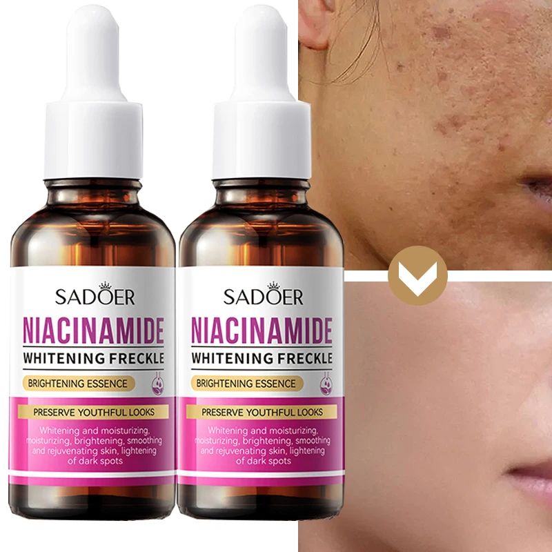 Niacinamide Serum for Face Brightening Serum Niacinamide Reduce Melasma Melanin Brighten Serum Dark Spot Remover Lighten Dark Skin Chloasma Serum Weaken Fine Lines Care - SADOER -