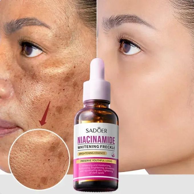 Niacinamide Dark Spot Remover Serum for Face Whitening Moisturizing Brighten Smoothing Facial Skin Care Removal Freckle Facial Serum Skin Care - SADOER -