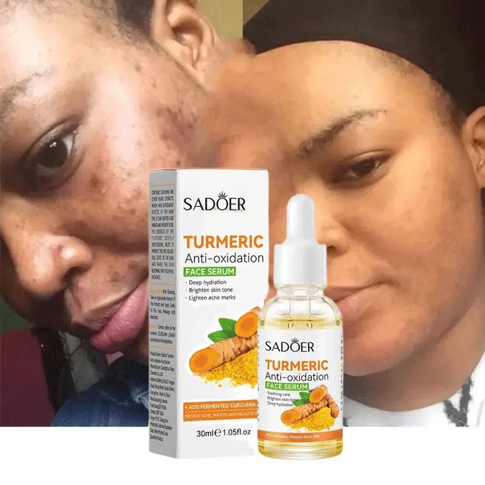 Turmeric Face Serum Moisturizing Turmeric Serum Original Brightening Nourishing Toner Anti-oxidant Hydrating Face Serum Nourishing Moisturizing Repair Skin Fade Dark Spot - SADOER -