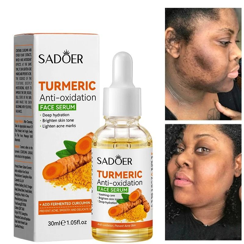 Turmeric Face Serum Moisturizing Turmeric Serum Original Brightening Nourishing Toner Anti-oxidant Hydrating Face Serum Nourishing Moisturizing Repair Skin Fade Dark Spot - SADOER -