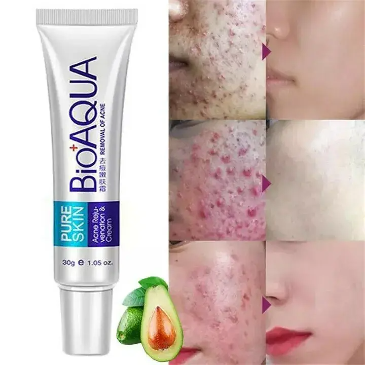 Acne Face Cream Pimple Marks Removal Oil Control Moisturizing  Smooth Facial Creams Skin Care Products - Bioaqua -