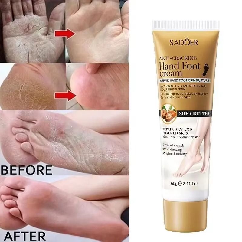 60g Anti Crack Foot Hand Cream Anti-drying Heel Cracked Removal Feet Skin Dead Care Feet Repair Moisturizing Whitening - SADOER -