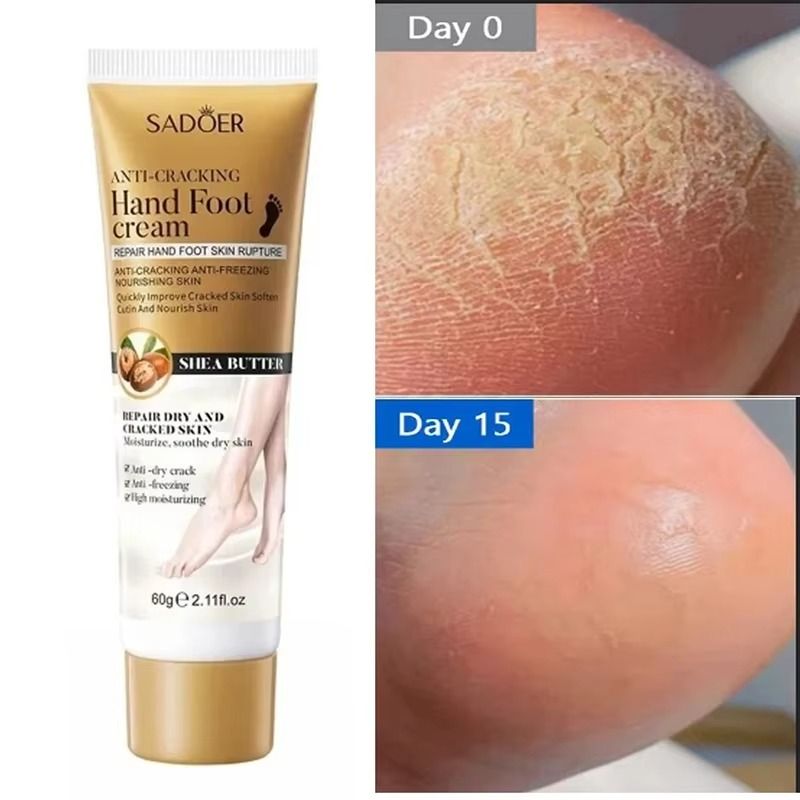 Anti-Drying Crack Foot Cream Heel Cracked Repair Cream Removal Dead Skin Moisturizing Hand Feet  Care - SADOER -