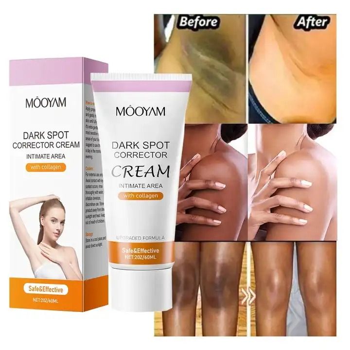 Whitening Cream dark Spots Remover Knuckles Skin Lightening Bleaching Cream Underarm Armpit Knees Elbows Dark Skin Whitening Intimate Body- MOOYAM -