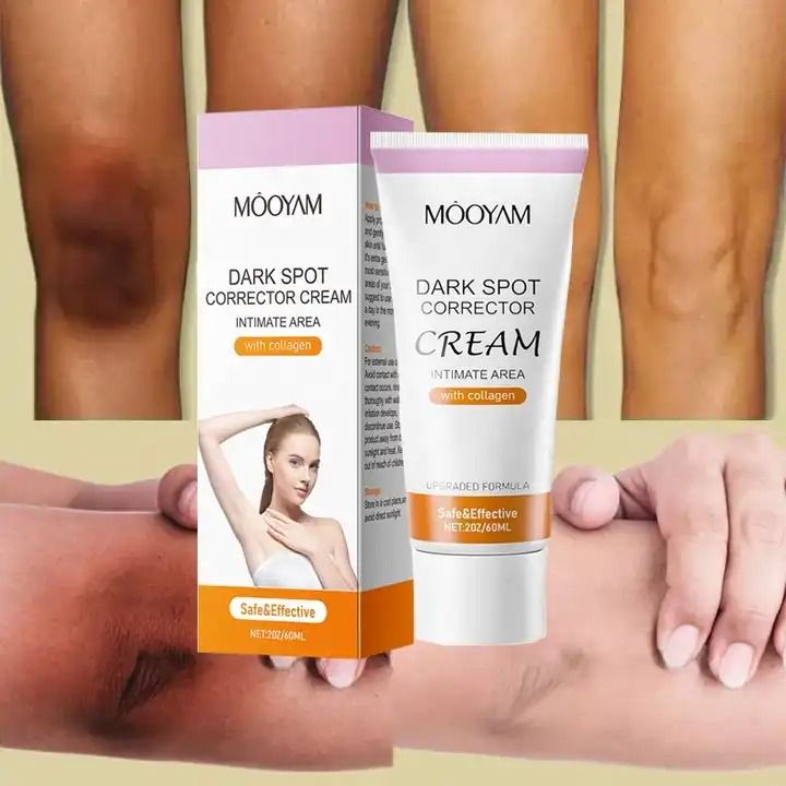 Whitening Cream dark Spots Remover Knuckles Skin Lightening Bleaching Cream Underarm Armpit Knees Elbows Dark Skin Whitening Intimate Body- MOOYAM -