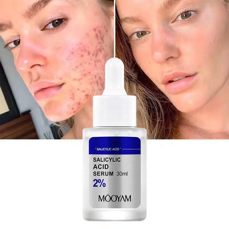 30ml Salicylic Acid Delicate Pore Acne Remover Oil Control Dark Spots Facial Essence Hydrating Moisturizing Gentle Care Shrinking Pore Water Light Beauty Face Serum- MOOYAM -