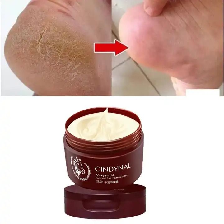 Anti-Crack Foot Cream Heel Cracked Repair Cream Rough Dry Foot Removal Dead Skin Moisturizing Hand Feet Mask Care Horse Oil -