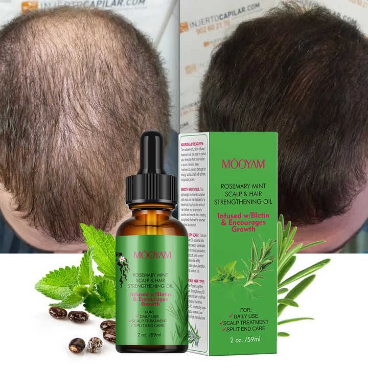 Rosemary Mint Hair Strengthening Oil Nourishing Treatment for Split Ends Hair Growth Organic Hair Care Oil - MOOYAM -