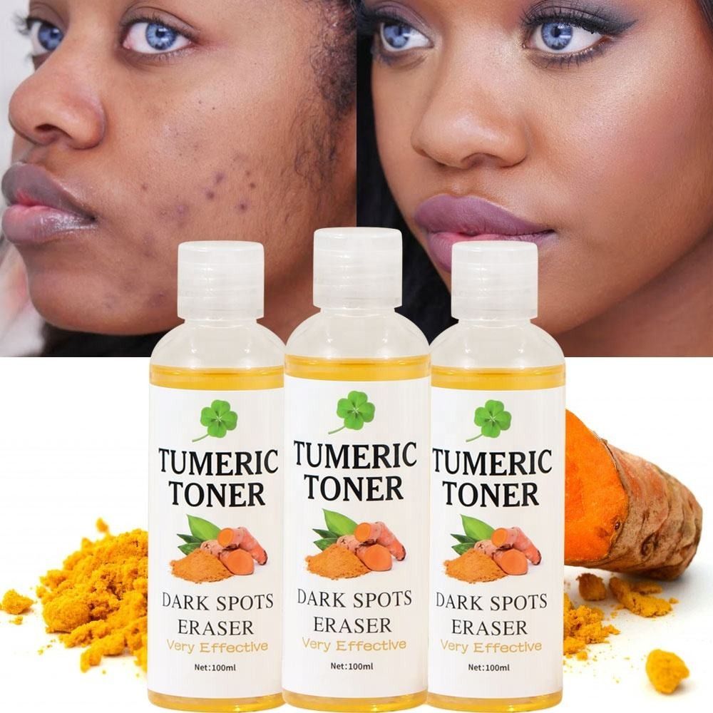 New 100ml Dark Spots Corrector Tumeric Toner Brighten Skin Repair Acne Prone Skin Blackheads Whiten Lighten Skin Freckles Hyperpigmentation Refine Pores Moisturizing Face -