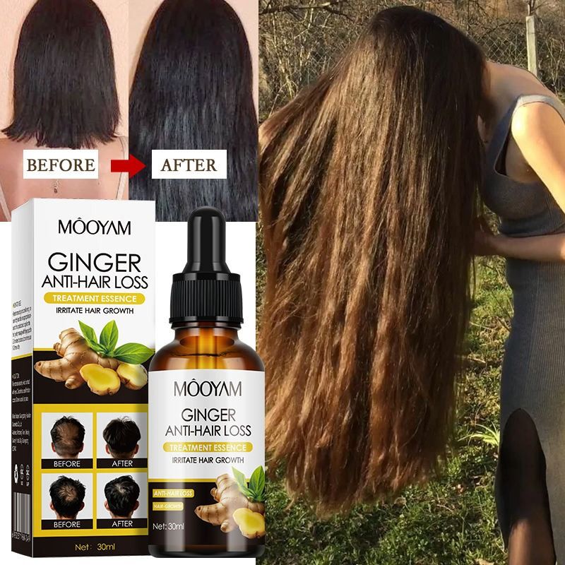 Quick Ginger Hair Growth Oil Roots Grow Anti Hair Loss Hair Regrowth Serum Scalp Damaged Repair Nourish Care Products Women Men - MOOYAM -