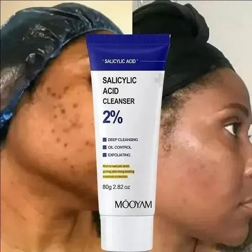 Face Wash Cleanser Salicylic Acid Acne Control Refreshing Facial Scrub Cleanser Deep Cleaning Gentle Exfoliating Oil Control Acne Treatment Cleanser Skin Care - MOOYAM -