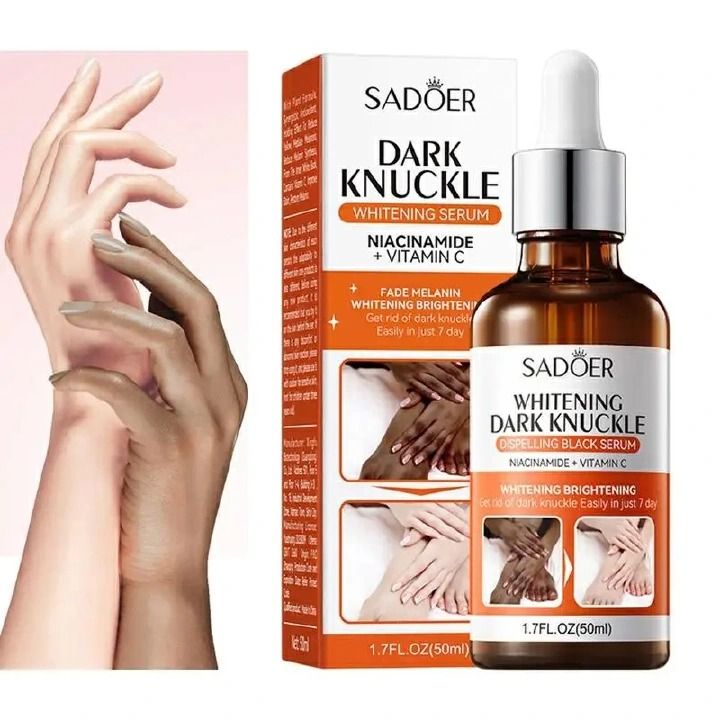 Fast Whitening Dark Knuckles Darks Spots Remover Serum Brighten Hand,Elbows,Knees Soften Moisturize Lighten Melanin Stains Corrector l Intense Stains Remover Products Beauty Care 50ml - SADOER -