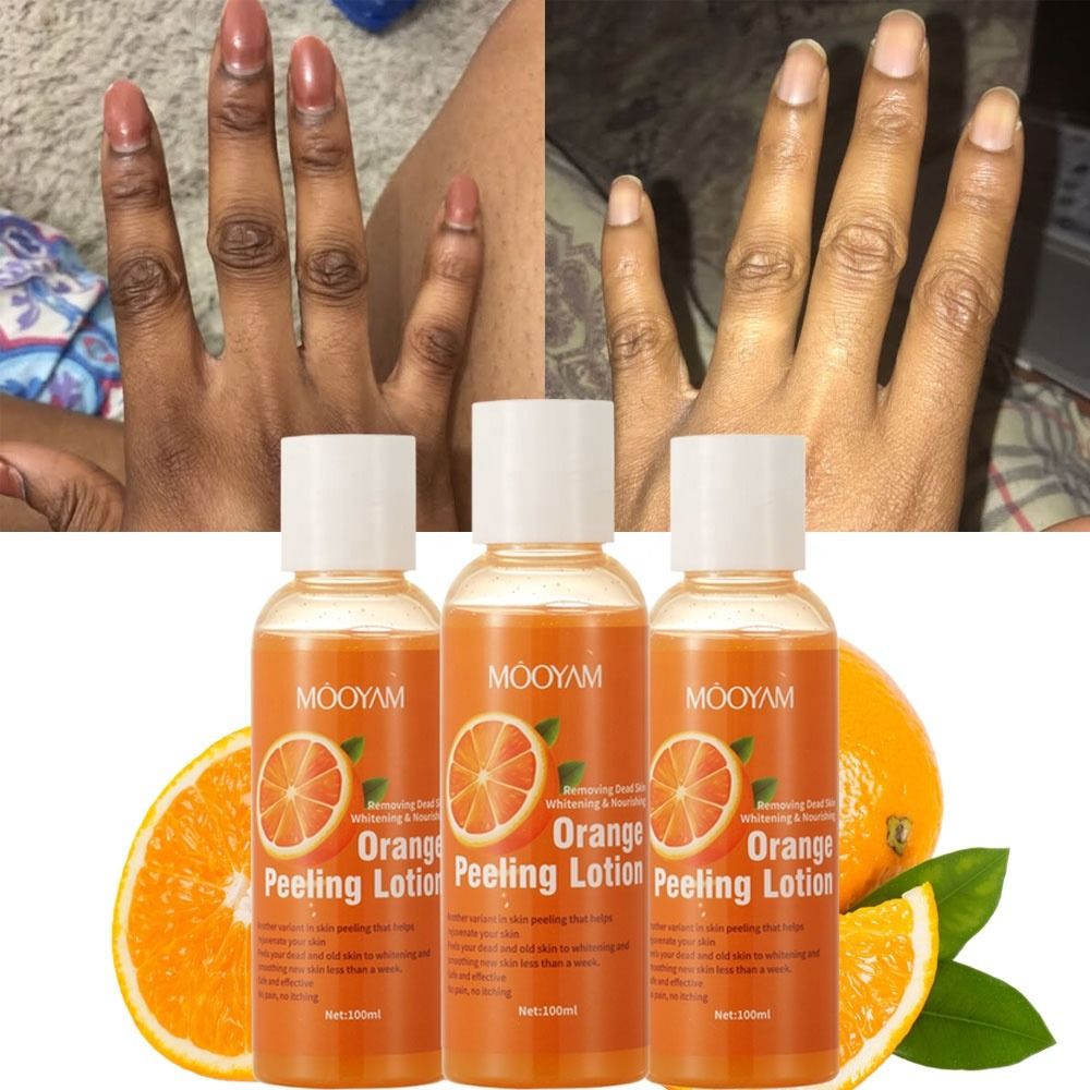 Whitening Black Skin Gentle Exfoliating Orange Peeling Lightening Body Face Lotion Strong Whitening Remove Blackheads & Moisturize Organic Lotion for Removing Dead Skin 100ML-