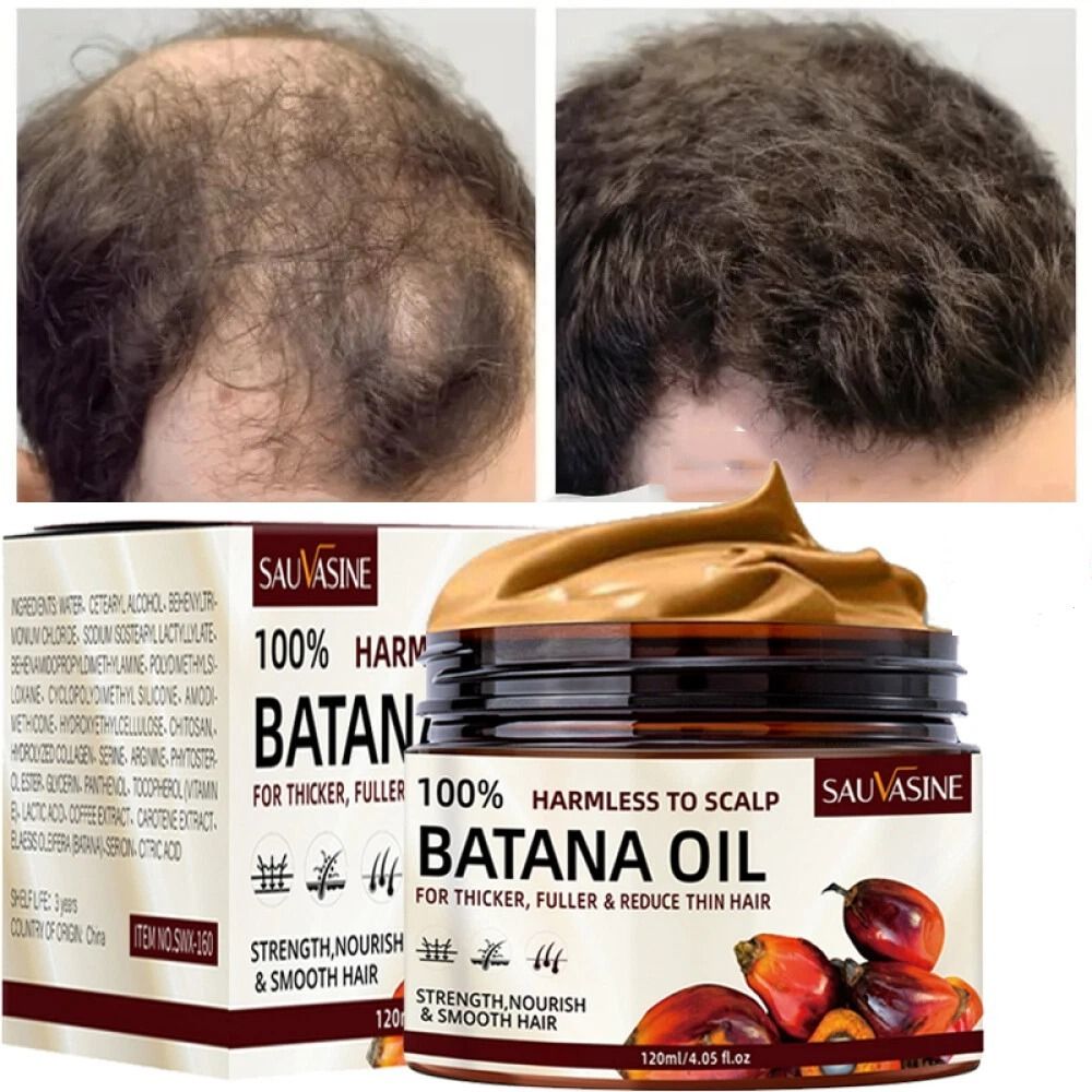 New Arrivals Batana Oil Fast Hair Growth for Women Men Pure Batana Oil Nourish Shiny Hair Healthy Hair Care Anti Hair Loss Hair Growth Care Repair Damaged For Men & Women - SAUVASINE -