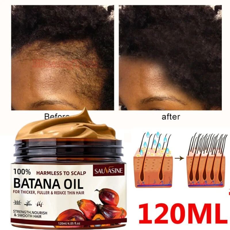100% Batana Oil Hair Strengthening Hair Growth Anti-Hair Loss Treatment Pure Batana Oil Butter Fast Hair Growth for Men Women Nourish Shiny Hair Healthy Hair Care Anti Hair Loss - SAUVASINE-