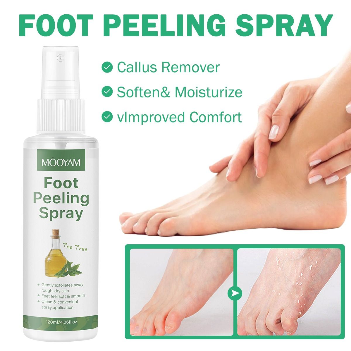 Foot Peeling Exfoliating Callus Remover Spray, Cracked Heel Repair, Rough Dry Skin Exfoliating & Moisturizing Foot Care Foot Peeling Spray, Tea Tree Foot Exfoliator Spray Pedicure Socks - MOOYAM -