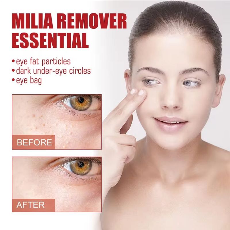 Hyaluronic Acid Eye Serum Remover fat particles Hyaluronic Acid Skin Care Eye Bags Cream Moisturizing Dark Circles Korean Care