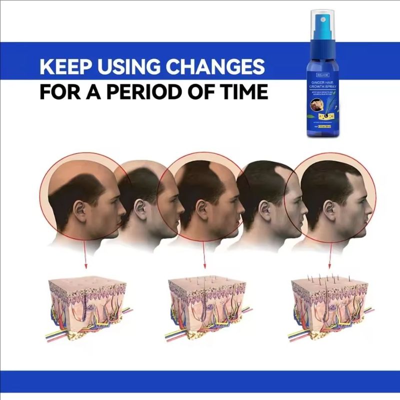 Ginger Hair Growth spray Anti Fall Loss Treatment Essence Oil for Men Women hair treatment