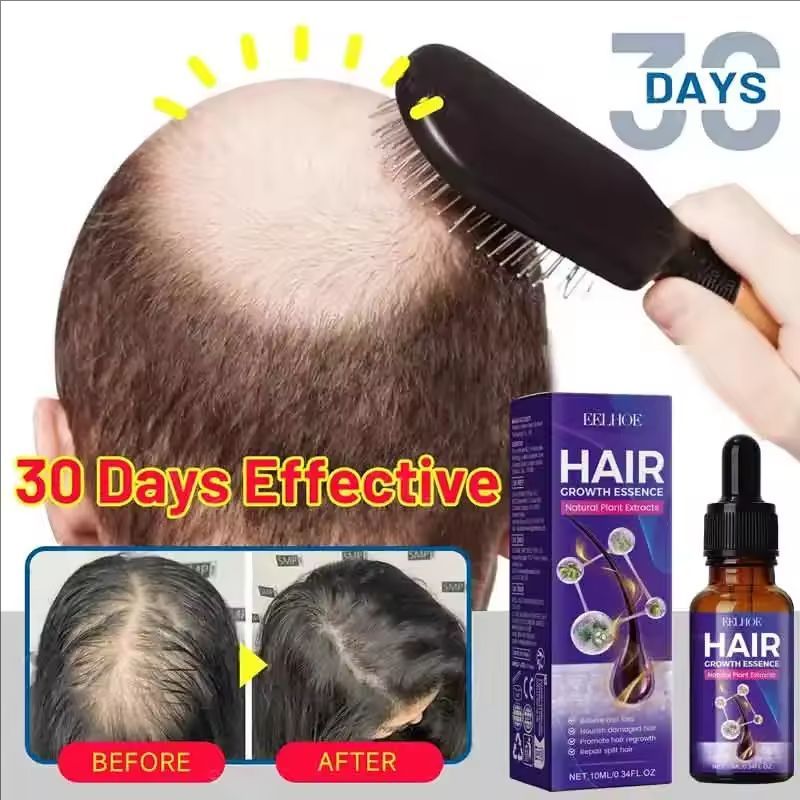 Hair Growth Essential Loss Regrowth Treatment Strengthens Hair Nourishes Scalp Light Weight Non Greasy Improve Scalp Circulation