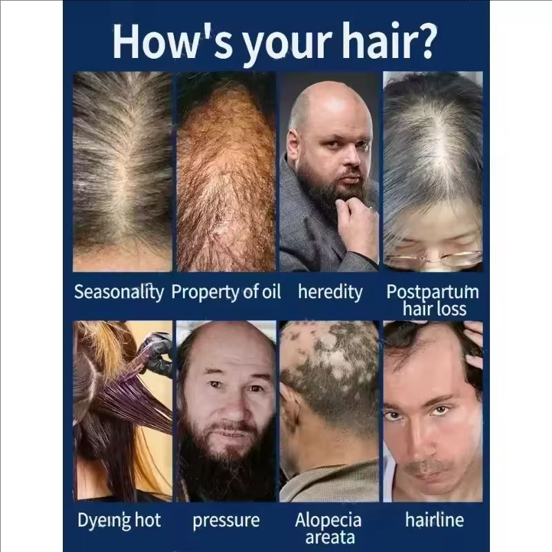 Hair Growth Essential Loss Regrowth Treatment Strengthens Hair Nourishes Scalp Light Weight Non Greasy Improve Scalp Circulation