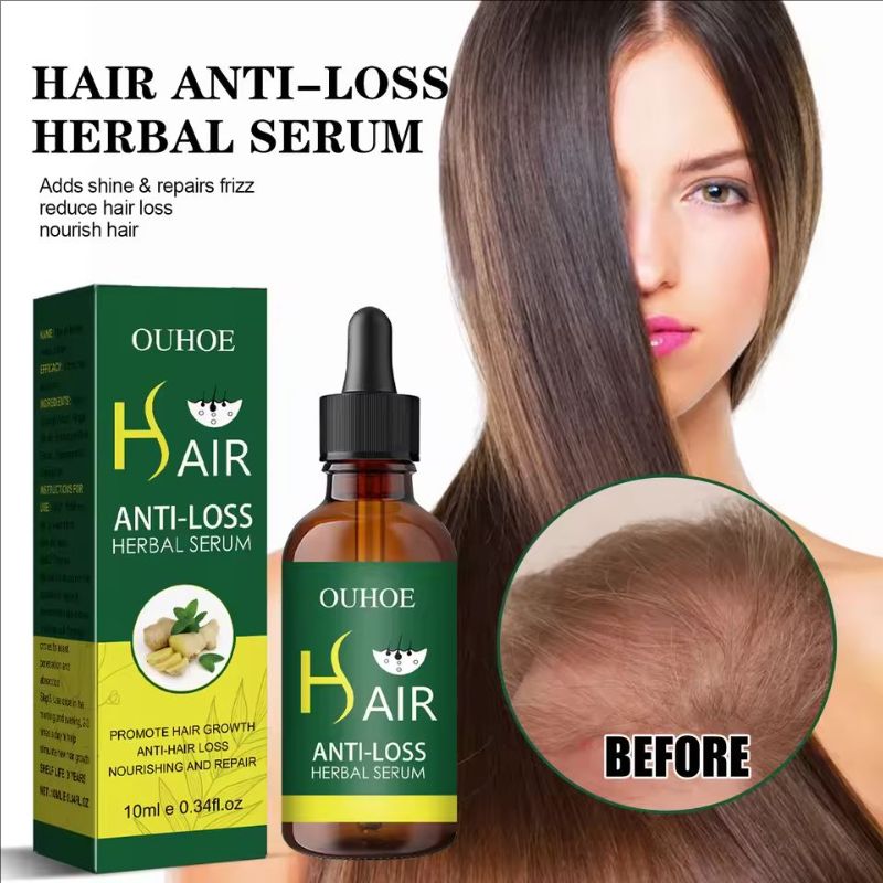 Fast Hair Growth Anti Alopecia Oil Ginger Essential High Hairline Head Hair Serum Hairless Baldhead Increase Essence Cream