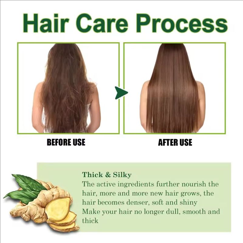 Fast Hair Growth Anti Alopecia Oil Ginger Essential High Hairline Head Hair Serum Hairless Baldhead Increase Essence Cream